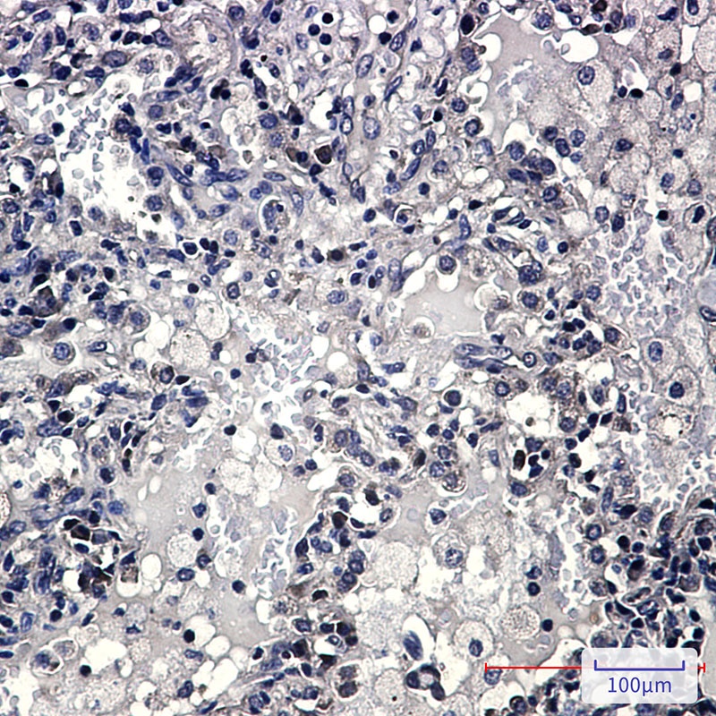 ZYX Antibody