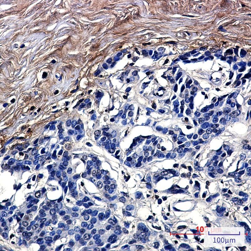 Tetranectin Rabbit Monoclonal Antibody