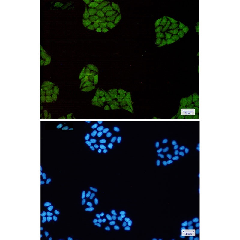 STAT1 Antibody
