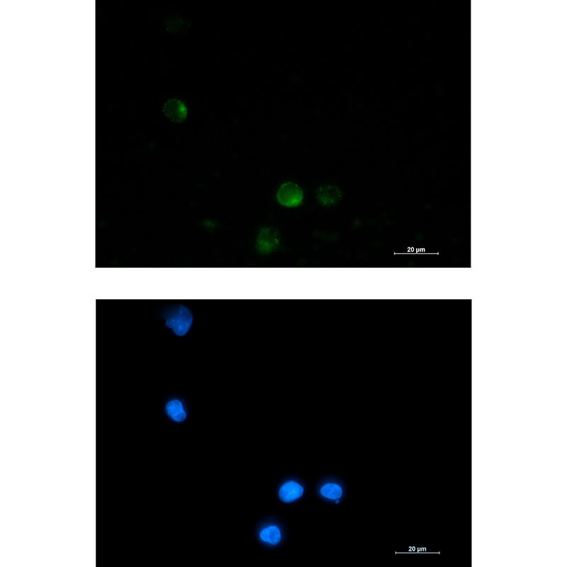 SSX2IP Antibody