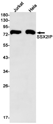 SSX2IP Antibody