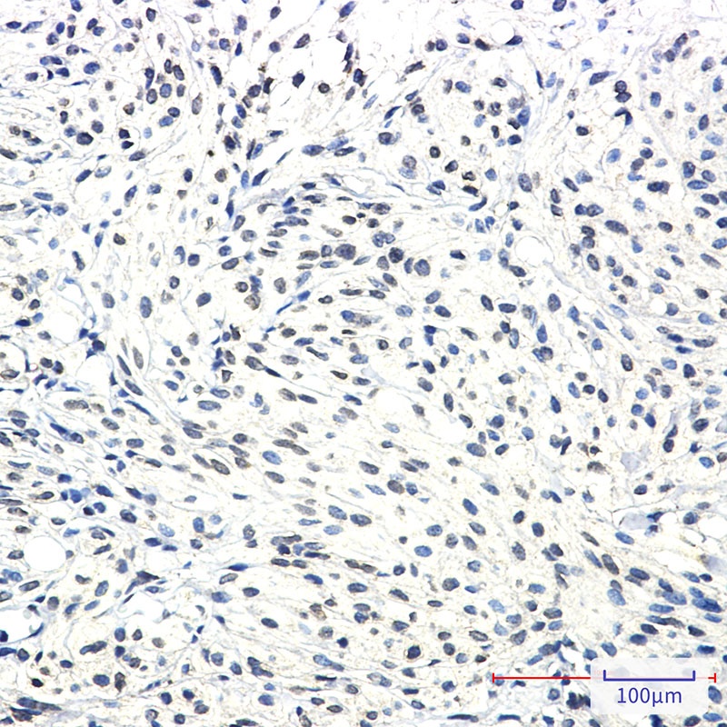 SSX2IP Antibody