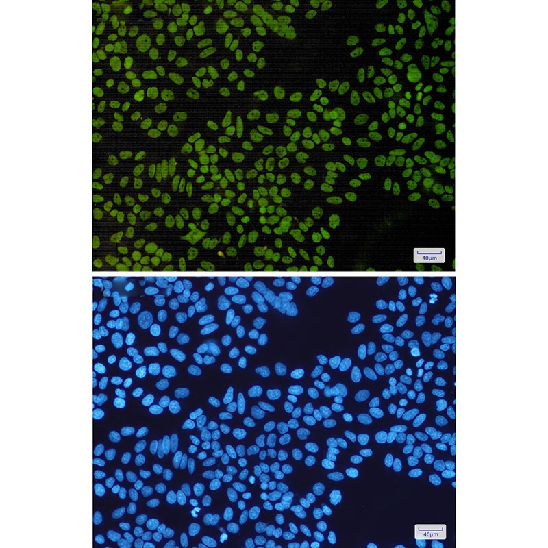 SNF5/SMARCB1 Rabbit Monoclonal Antibody