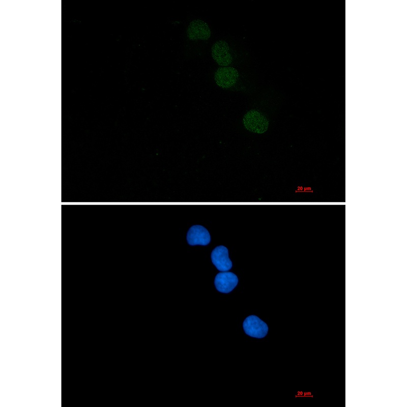 SAE1 Antibody