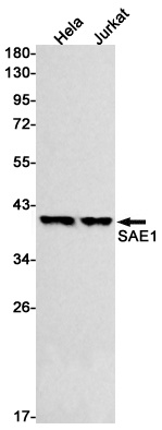 SAE1 Antibody