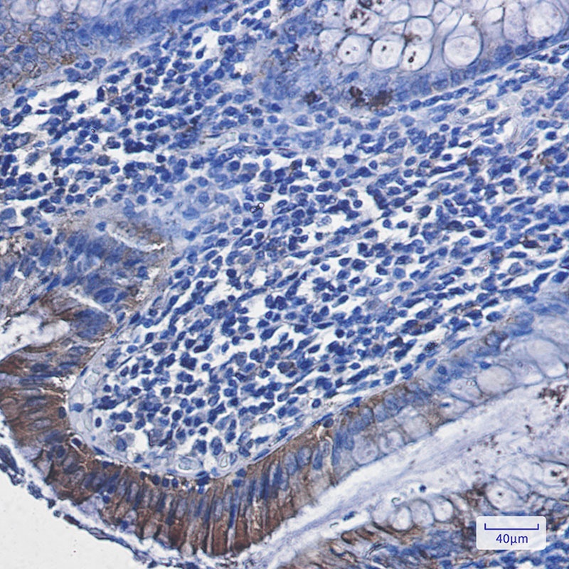 RAVER2 Antibody