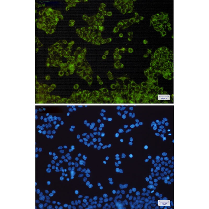 NDUFB9 Antibody