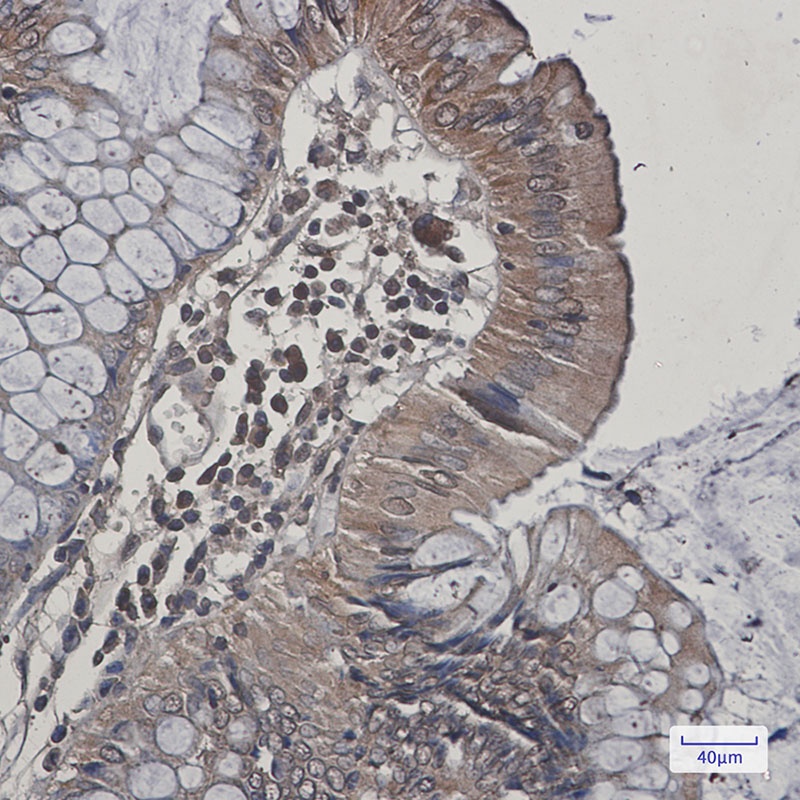 MAPK9 Antibody
