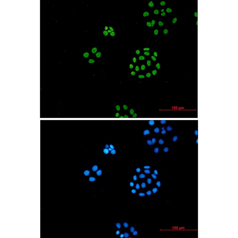 ILF3 Antibody