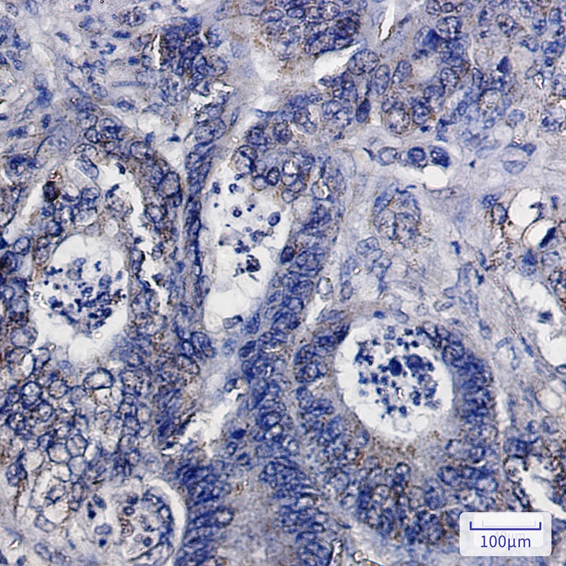 IDH2 Antibody