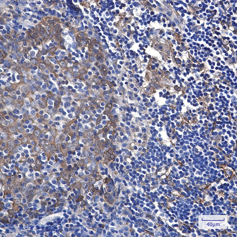 HSPB1 Antibody