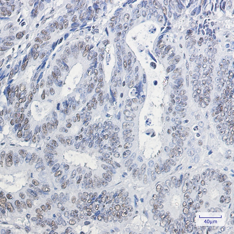 HP1 gamma Rabbit Monoclonal Antibody