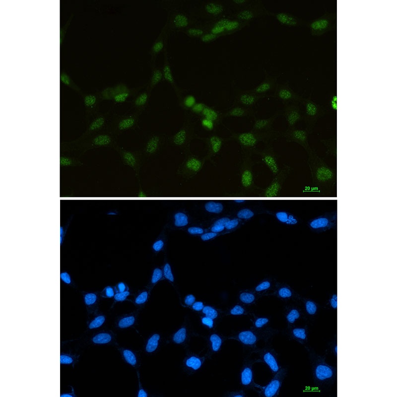 RBMX Antibody