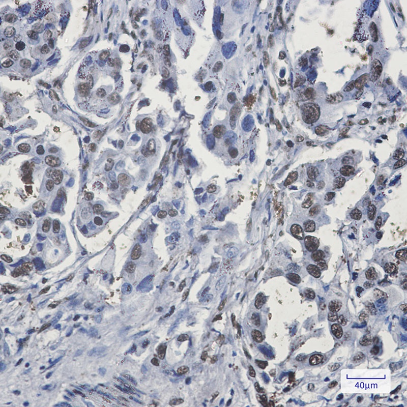 RBMX Antibody