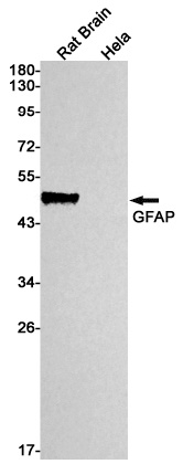 GFAP Antibody