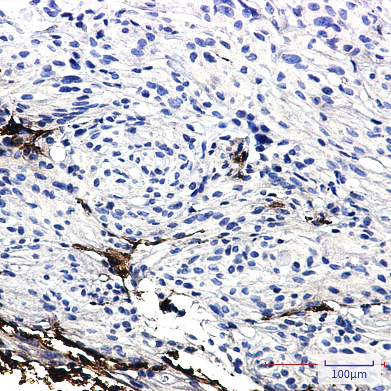 GFAP Antibody