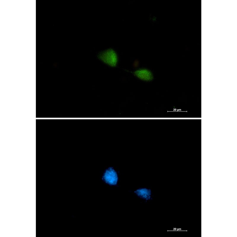 FUBP1 Antibody