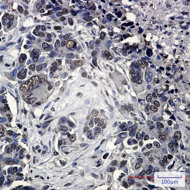 FUBP1 Antibody