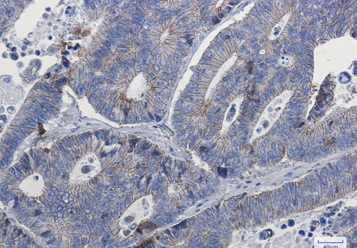 CTNND1 Antibody