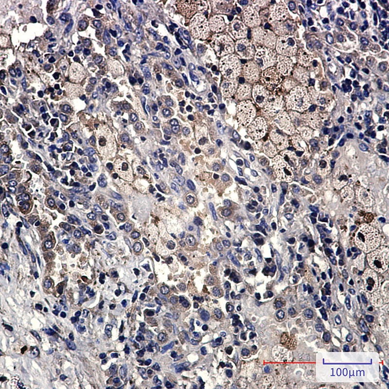 TNFRSF10D Antibody