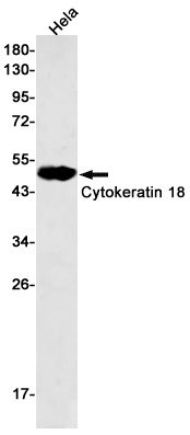 KRT18 Antibody