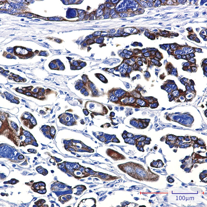 KRT18 Antibody