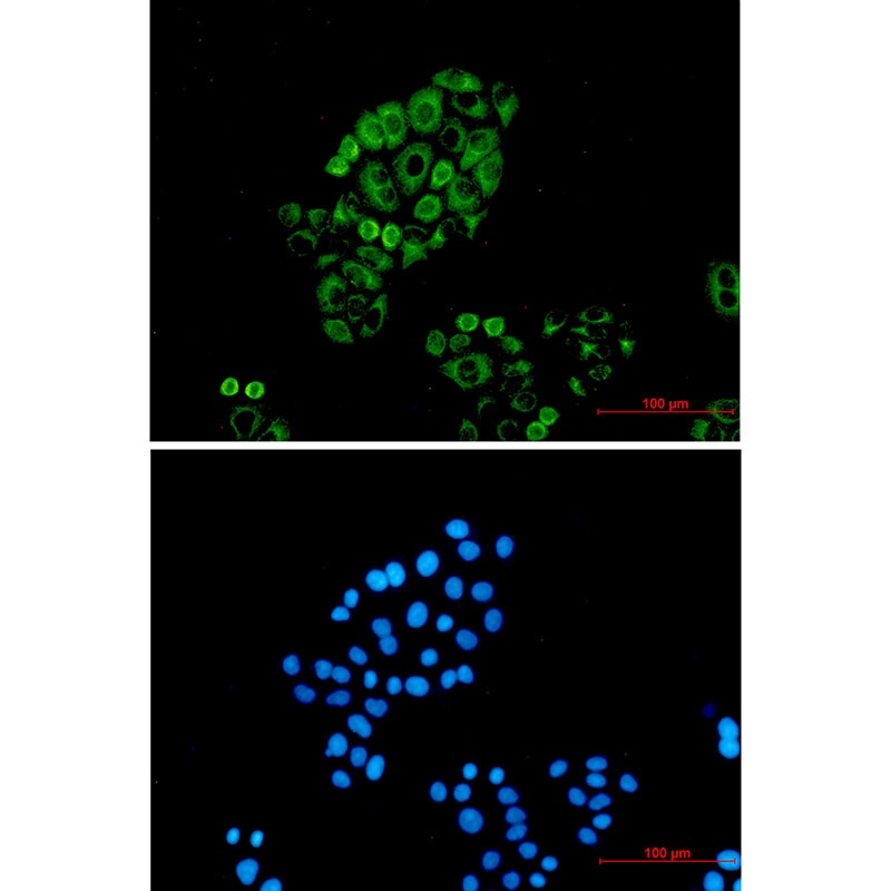 KRT18 Antibody