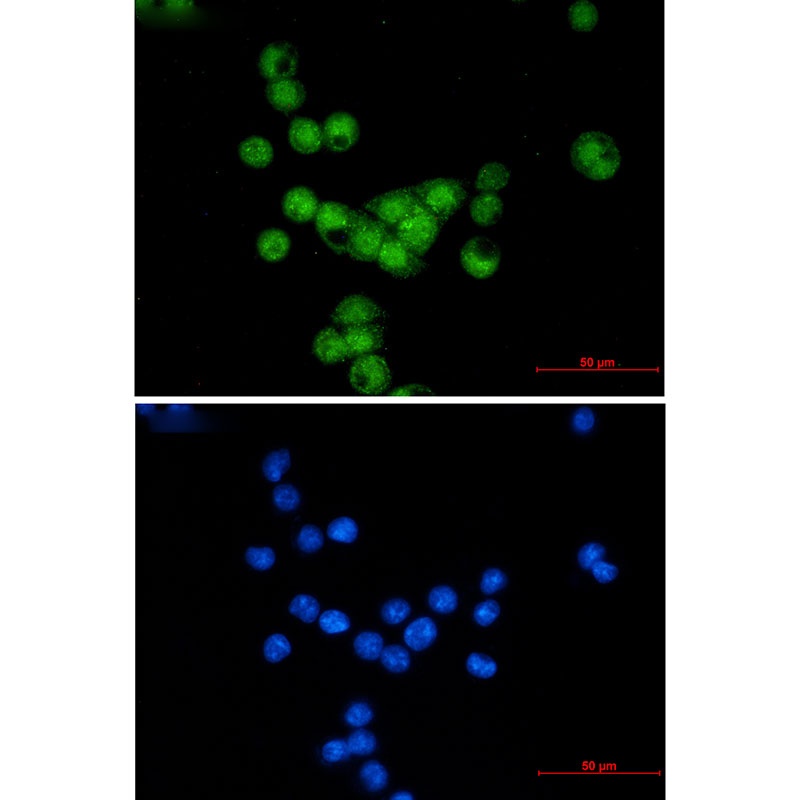 Cyclin E2 Rabbit Monoclonal Antibody