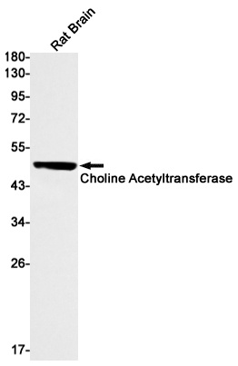 Choline Acetyltransferase Rabbit Monoclonal Antibody
