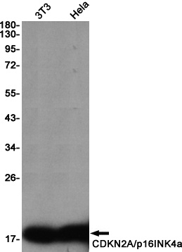 CDKN2A/p16INK4a Rabbit Monoclonal Antibody