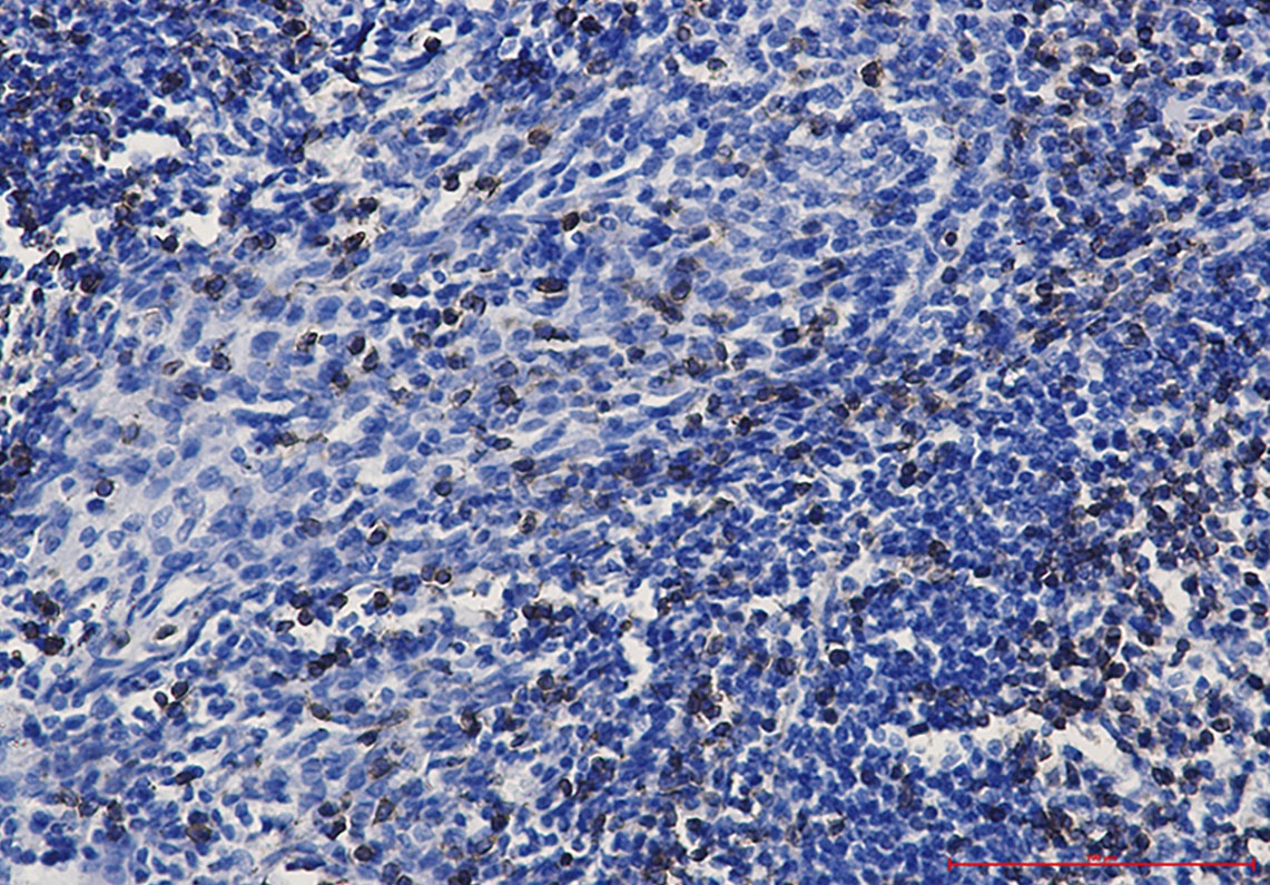 CD3E Antibody