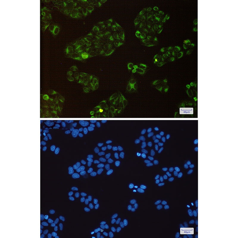 BCAP31 Antibody