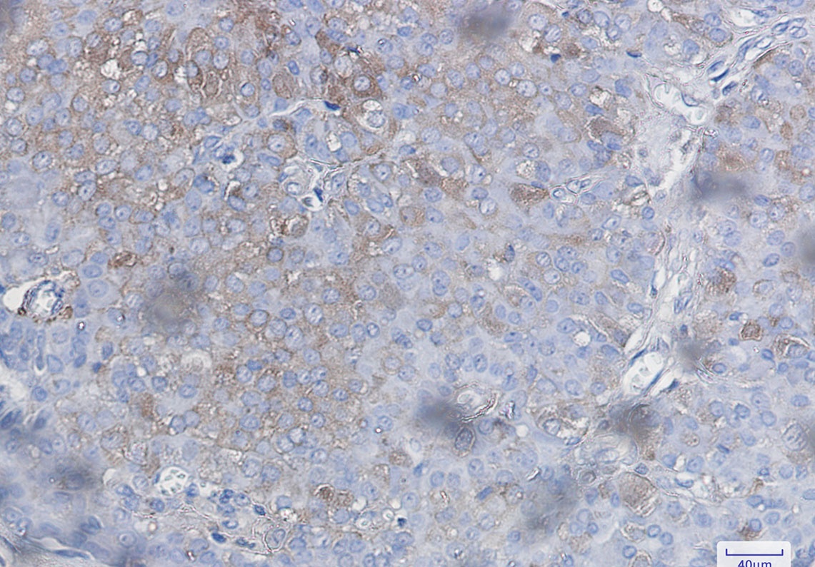BAD Antibody