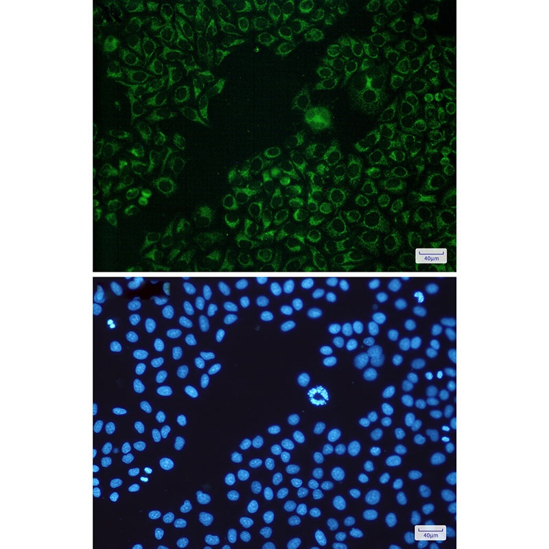 BAD Antibody