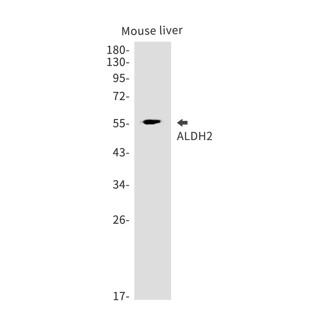 ALDH2 Rabbit Monoclonal Antibody