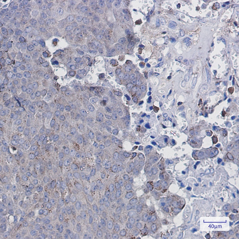 Adipose Triglyceride Lipase Rabbit Monoclonal Antibody