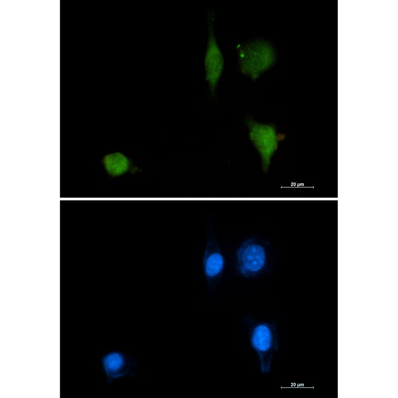 CTNND1 Antibody