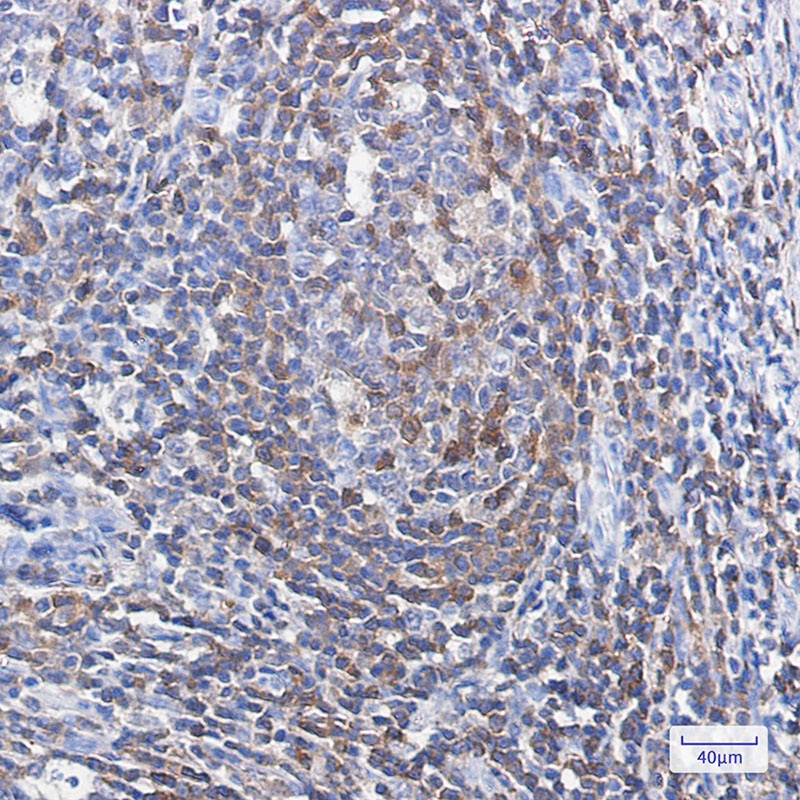 Profilin 1 Rabbit Monoclonal Antibody