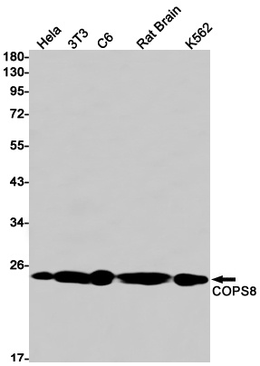 COPS8 Rabbit Monoclonal Antibody