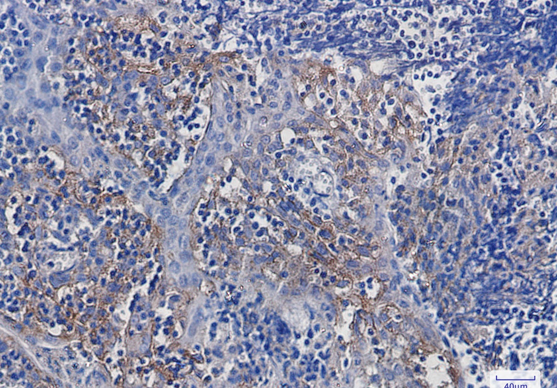 ITGAV Antibody