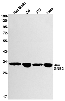 GNB2 Antibody