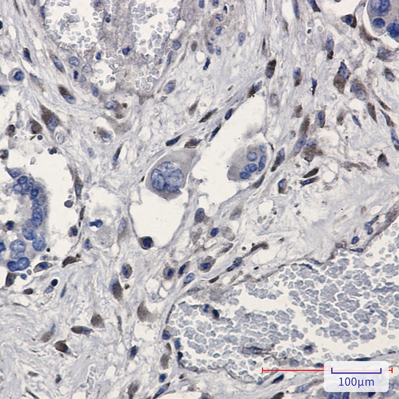 GNB2 Antibody