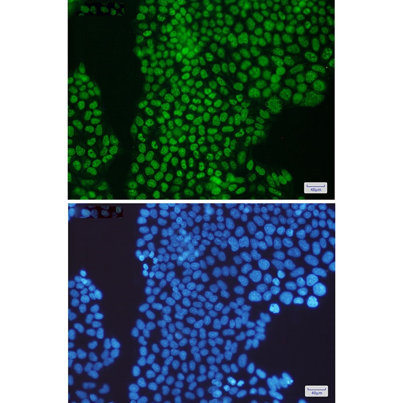 PCNA Antibody