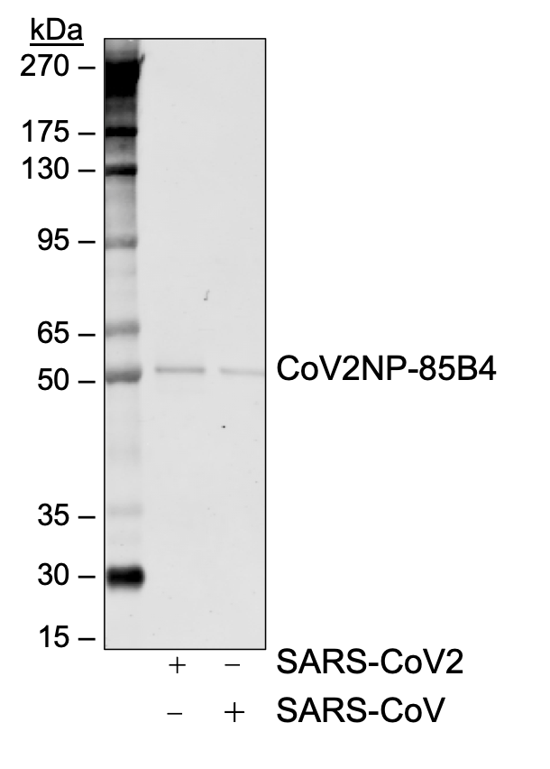 SARS-CoV-2 Nucleoprotein (NP) rabbit mAb Antibody