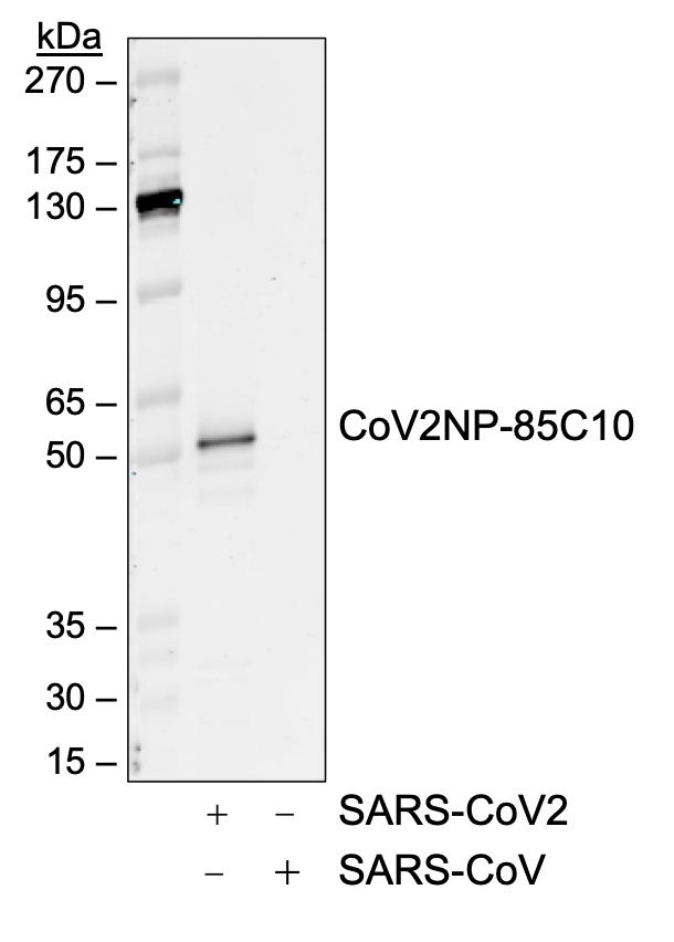 SARS-CoV-2 Nucleoprotein (NP) rabbit mAb Antibody