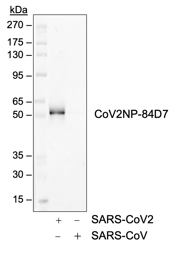 SARS-CoV-2 Nucleoprotein (NP) rabbit mAb Antibody
