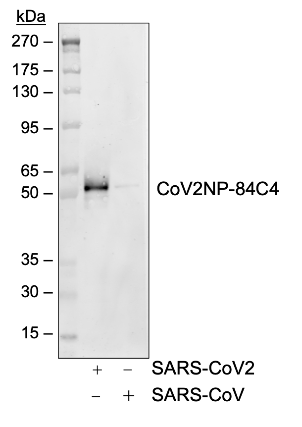 SARS-CoV-2 Nucleoprotein (NP) rabbit mAb Antibody