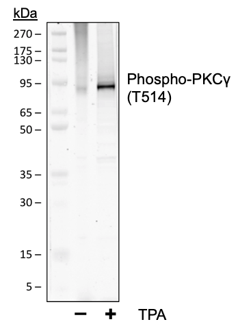 Phospho-PKC (pan) (gamma Thr514) rabbit mAb Antibody