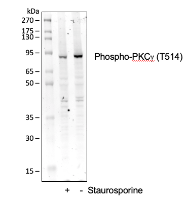 Phospho-PKC (pan) (gamma Thr514) rabbit mAb Antibody