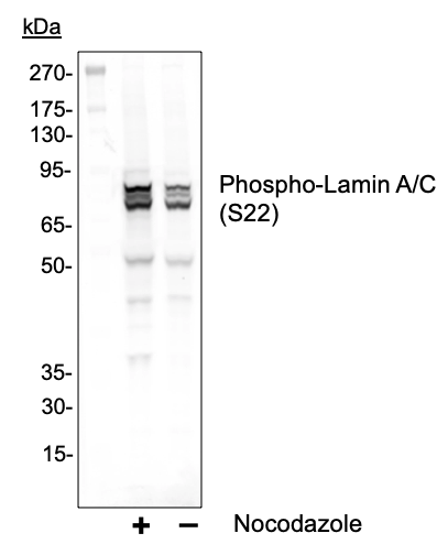 Phospho-Lamin A/C (Ser22) rabbit mAb Antibody